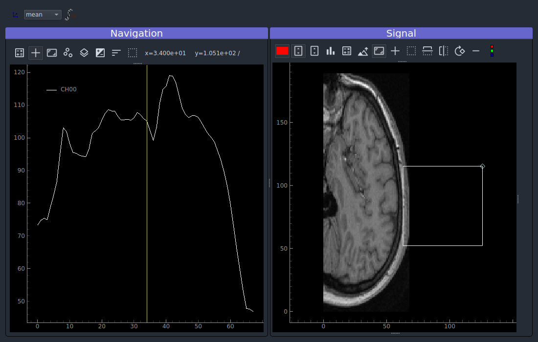 Showing brain 3D data on a ViewerND