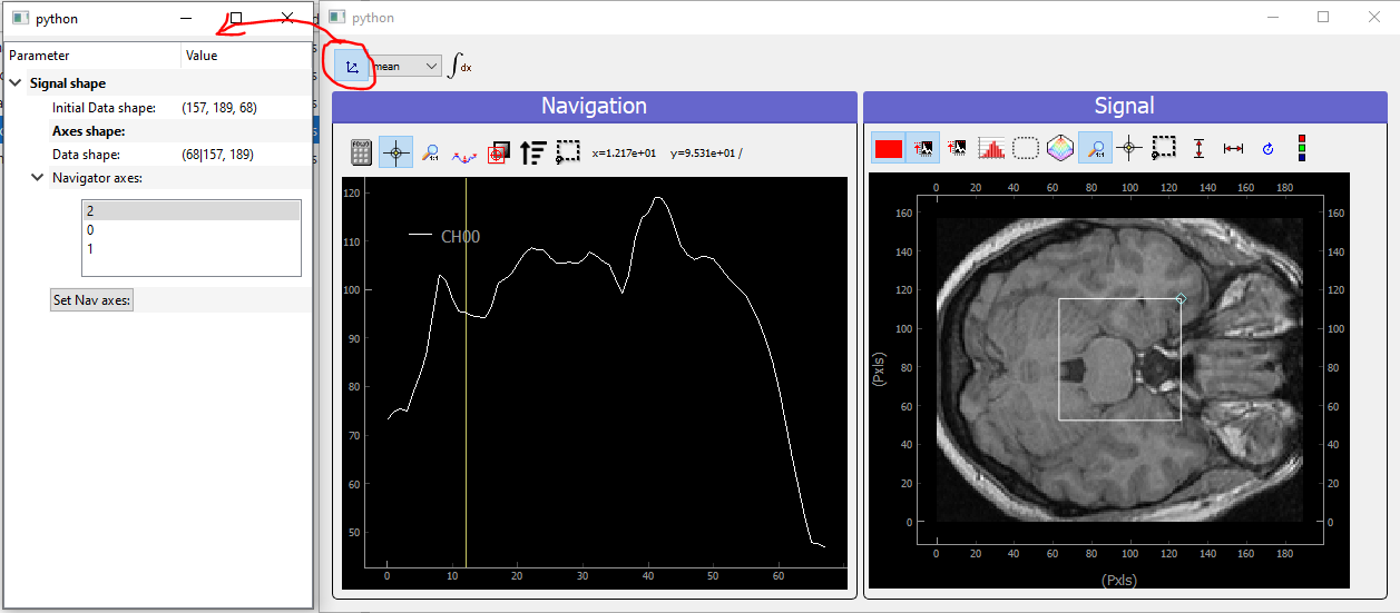 Showing brain 3D data on a ViewerND